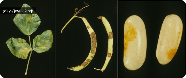 угловатая бактериальная пятнистость фасоли (pseudomonas syringae pv. phaseolicola (burkholder)young et al.)